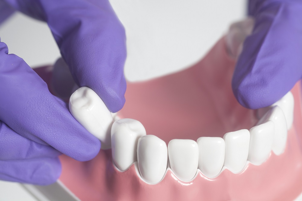 The Functions of Molars and Wisdom Teeth