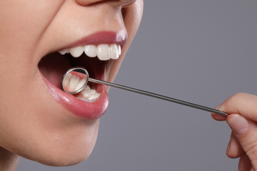 The Most Common Types of Cavities and How to Treat Them