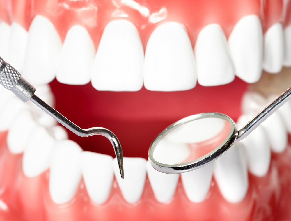 Tooth Bonding: Who Needs It?