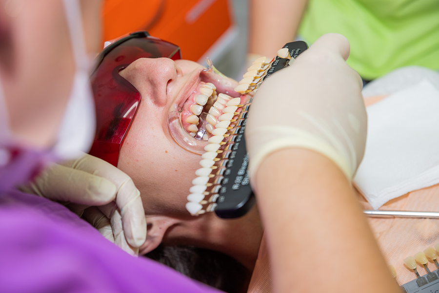 Good Veneers, Bad Veneers: What’s the Difference?