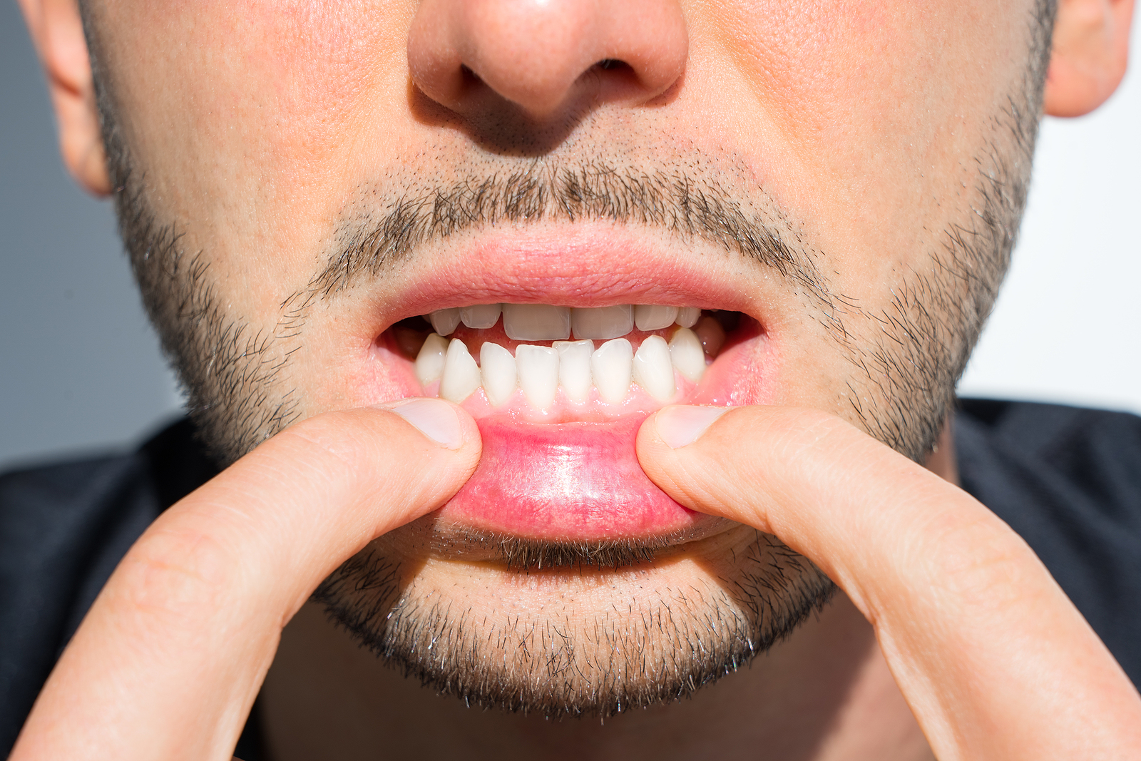 Early Warning Signs of Gum Disease