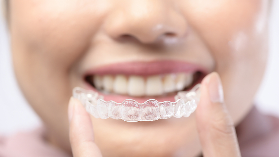 Benefits of Invisalign