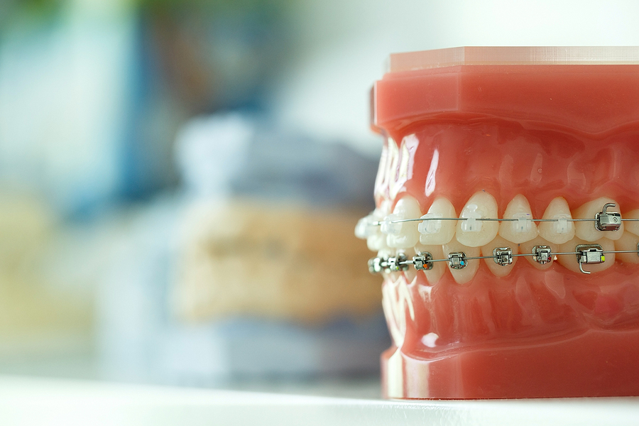 Achieve a Perfect Smile with Expert Orthodontics in Plantation, FL