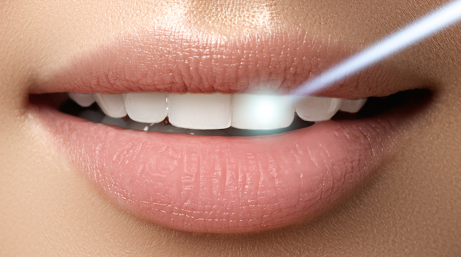 Achieve a Brighter Smile with Teeth Whitening (Zoom) in Plantation, FL